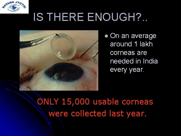 IS THERE ENOUGH? . . l On an average around 1 lakh corneas are