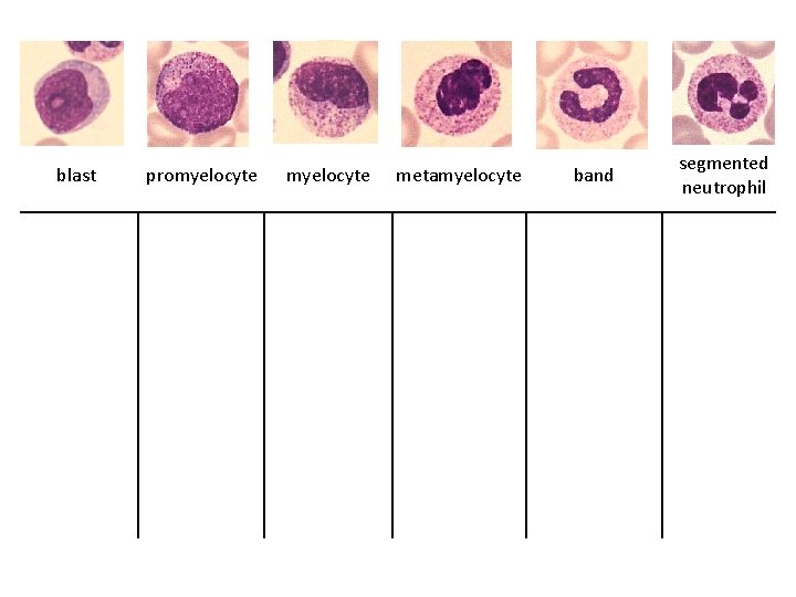 blast promyelocyte metamyelocyte band segmented neutrophil 