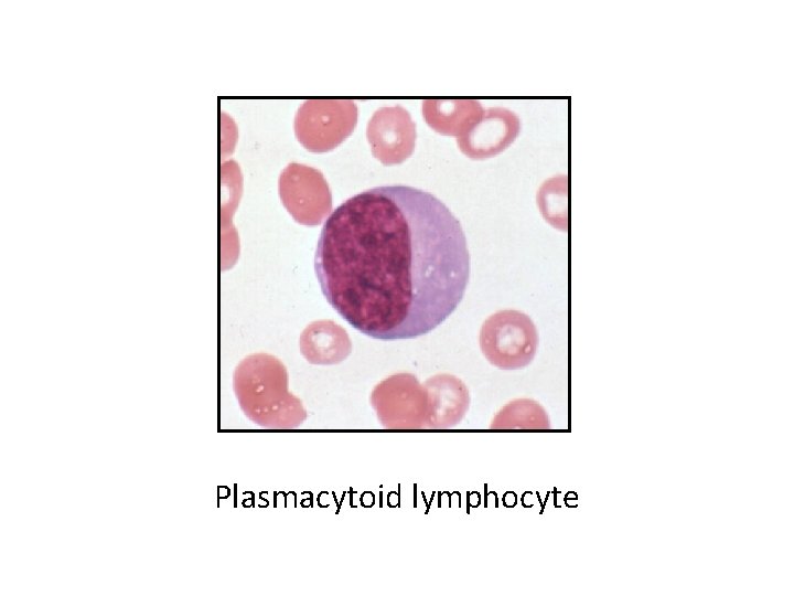 Plasmacytoid lymphocyte 