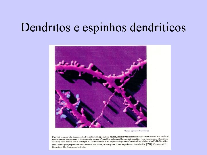 Dendritos e espinhos dendríticos 