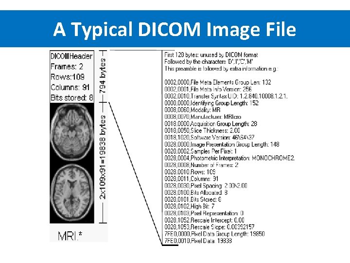 A Typical DICOM Image File 