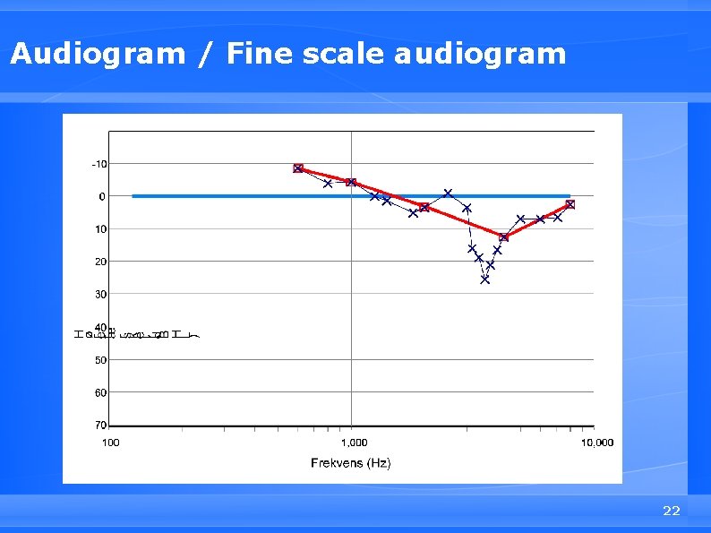 Audiogram / Fine scale audiogram 22 