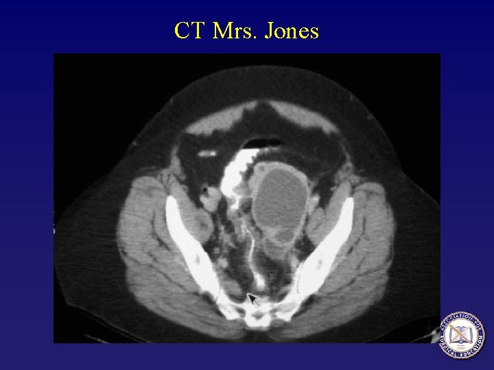 CT Mrs. Jones 
