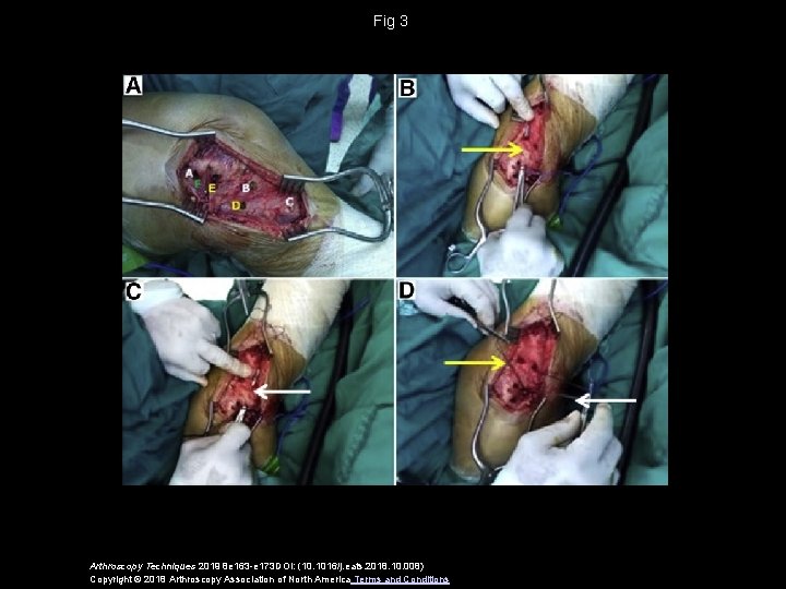 Fig 3 Arthroscopy Techniques 2019 8 e 163 -e 173 DOI: (10. 1016/j. eats.