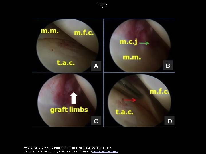 Fig 7 Arthroscopy Techniques 2019 8 e 163 -e 173 DOI: (10. 1016/j. eats.