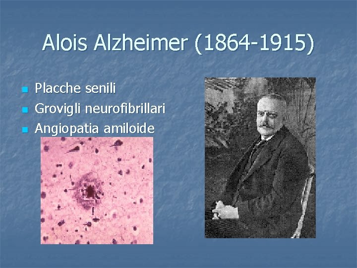 Alois Alzheimer (1864 -1915) n n n Placche senili Grovigli neurofibrillari Angiopatia amiloide 