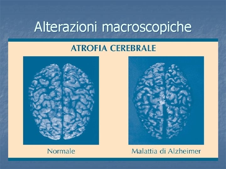 Alterazioni macroscopiche 