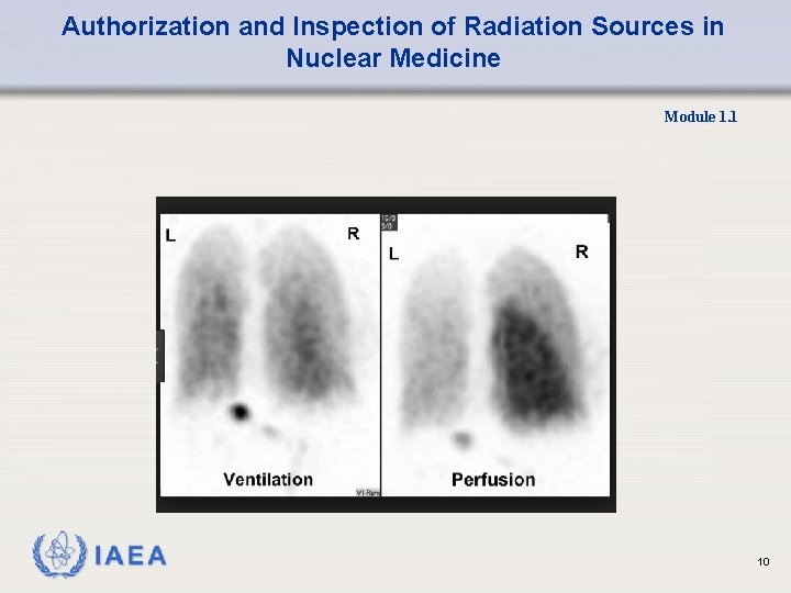 Authorization and Inspection of Radiation Sources in Nuclear Medicine Module 1. 1 10 