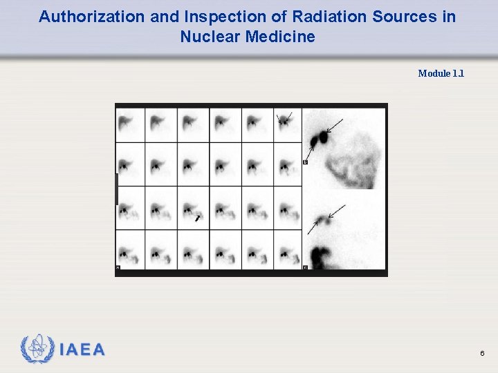 Authorization and Inspection of Radiation Sources in Nuclear Medicine Module 1. 1 6 