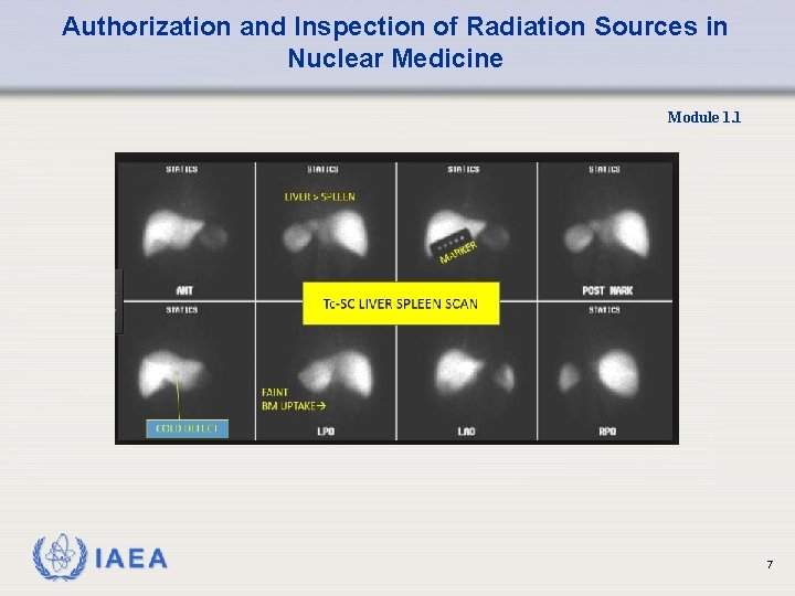 Authorization and Inspection of Radiation Sources in Nuclear Medicine Module 1. 1 7 