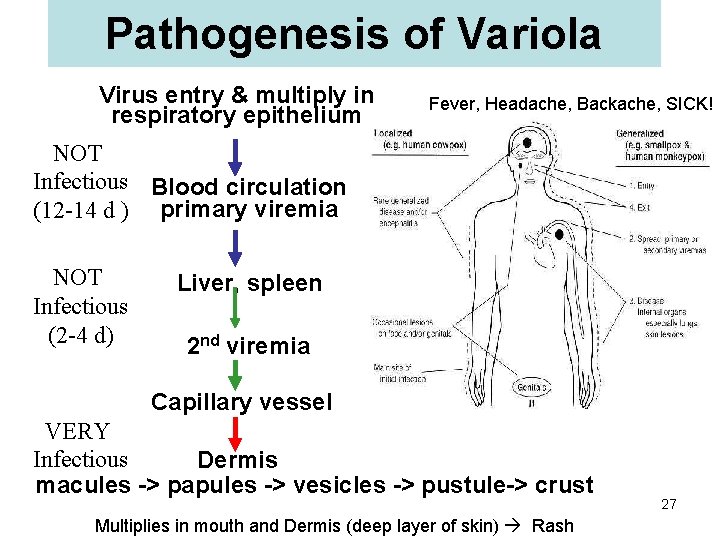 Pathogenesis of Variola Virus entry & multiply in respiratory epithelium Fever, Headache, Backache, SICK!