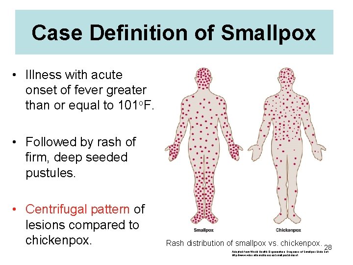 Case Definition of Smallpox • Illness with acute onset of fever greater than or