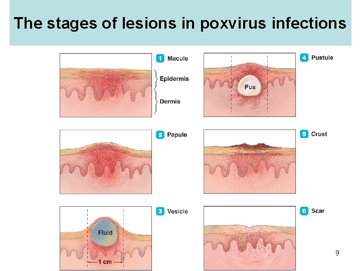 The stages of lesions in poxvirus infections 29 