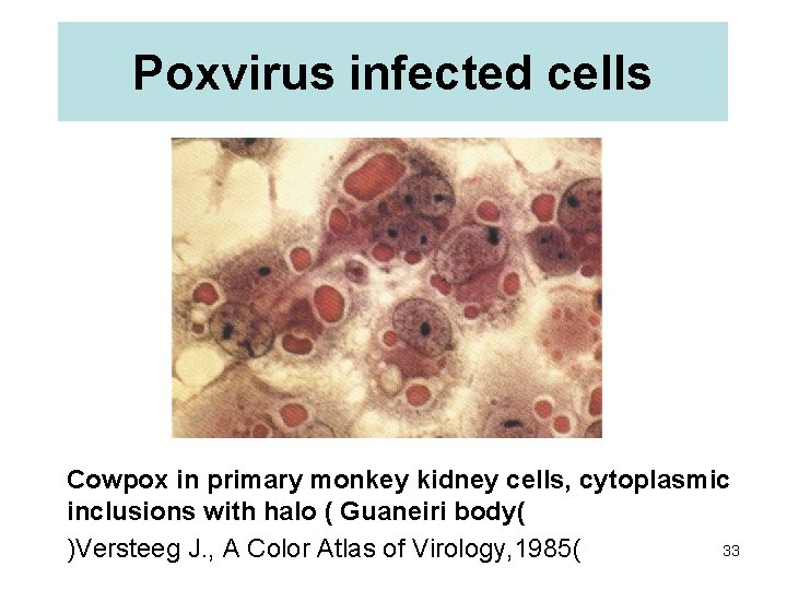 Poxvirus infected cells Cowpox in primary monkey kidney cells, cytoplasmic inclusions with halo (