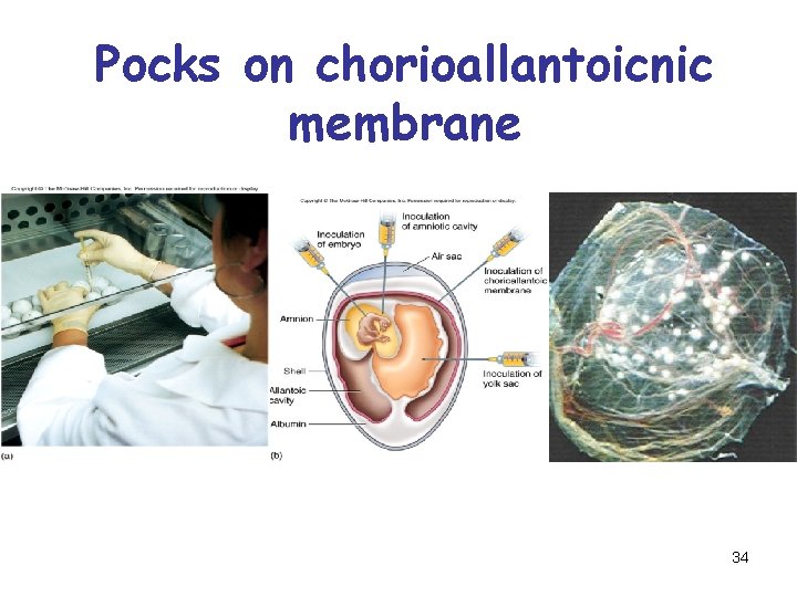 Pocks on chorioallantoicnic membrane 34 