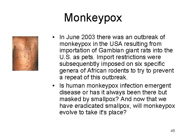 Monkeypox • In June 2003 there was an outbreak of monkeypox in the USA