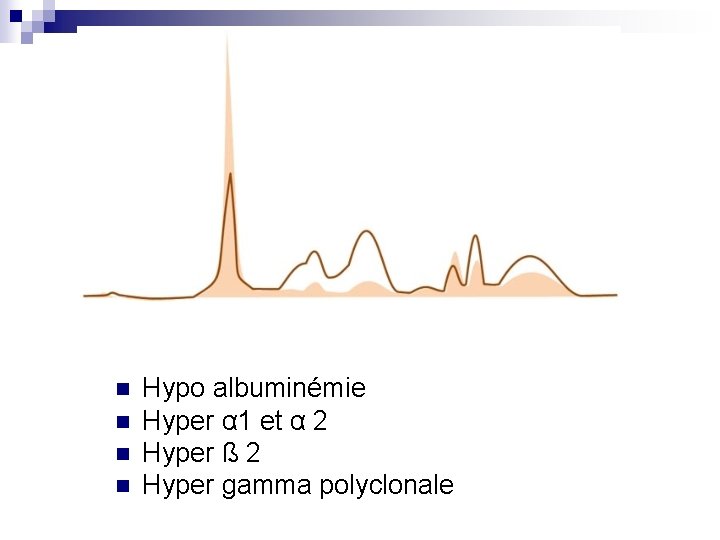 n n Hypo albuminémie Hyper α 1 et α 2 Hyper ß 2 Hyper