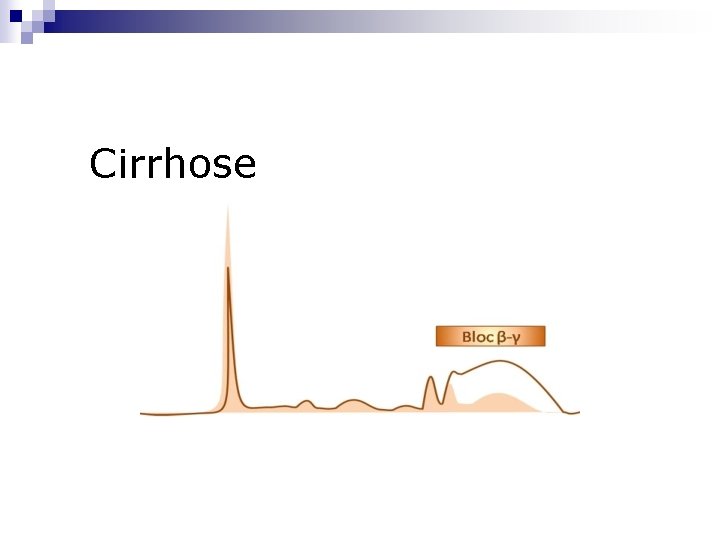Cirrhose 