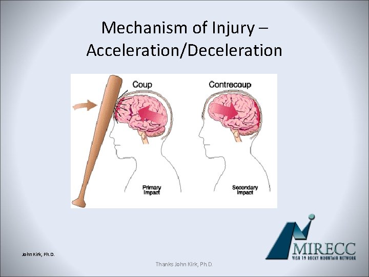 Mechanism of Injury – Acceleration/Deceleration John Kirk, Ph. D. Thanks John Kirk, Ph. D.