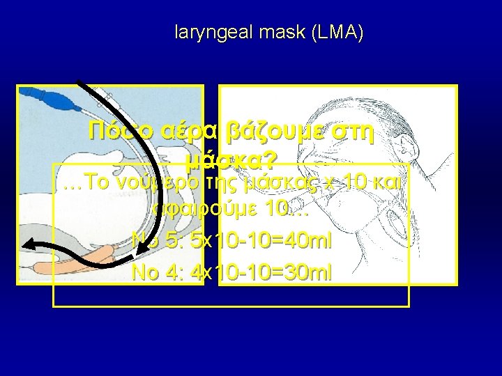 Techniques Equipment in basic airway management The ABCDE