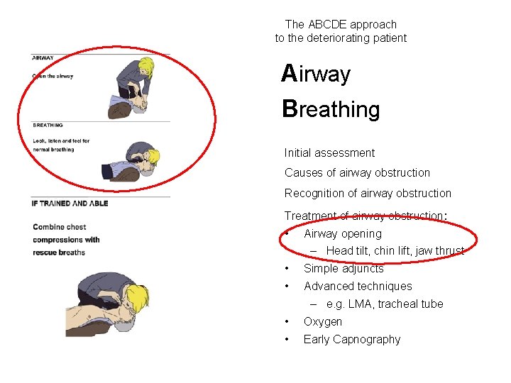 Techniques Equipment in basic airway management The ABCDE
