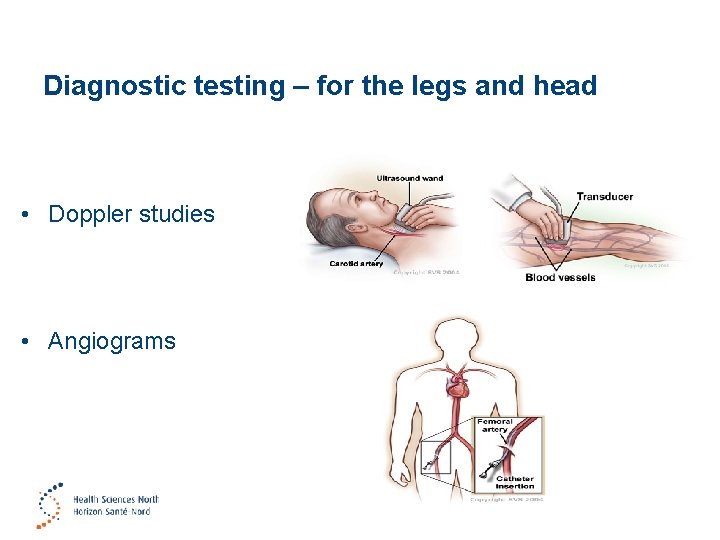 Diagnostic testing – for the legs and head • Doppler studies • Angiograms 