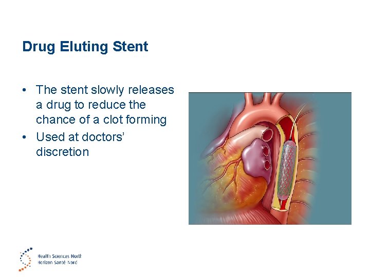 Drug Eluting Stent • The stent slowly releases a drug to reduce the chance