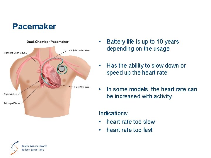 Pacemaker • Battery life is up to 10 years depending on the usage •