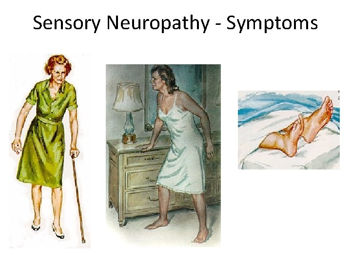 Sensory Neuropathy - Symptoms 
