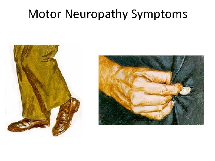 Motor Neuropathy Symptoms 