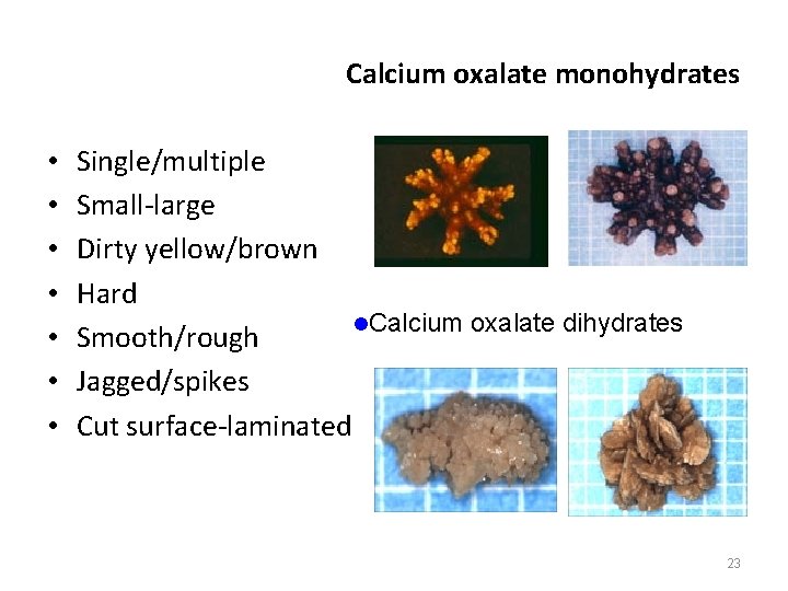 Calcium oxalate monohydrates • • Single/multiple Small-large Dirty yellow/brown Hard l. Calcium oxalate dihydrates