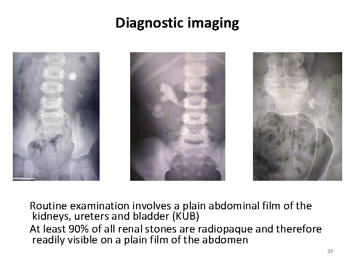 Diagnostic imaging Routine examination involves a plain abdominal film of the kidneys, ureters and