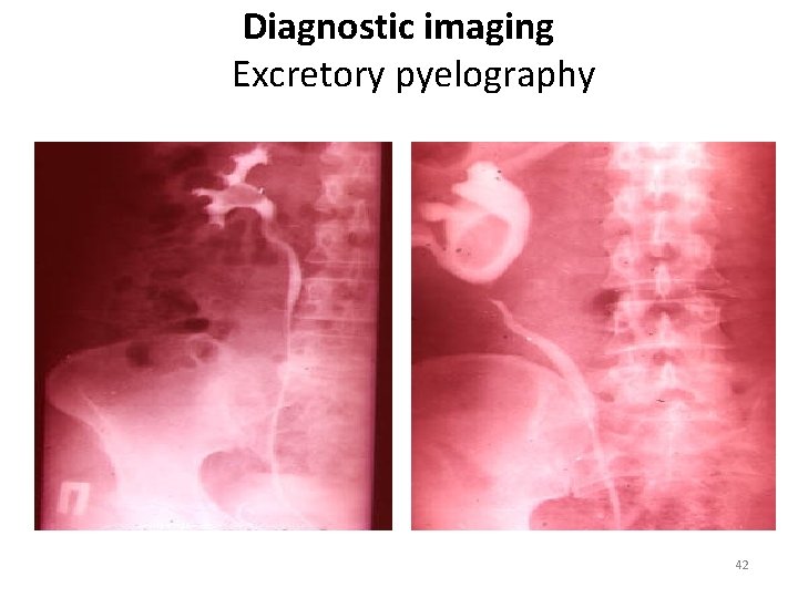 Diagnostic imaging Excretory pyelography 42 