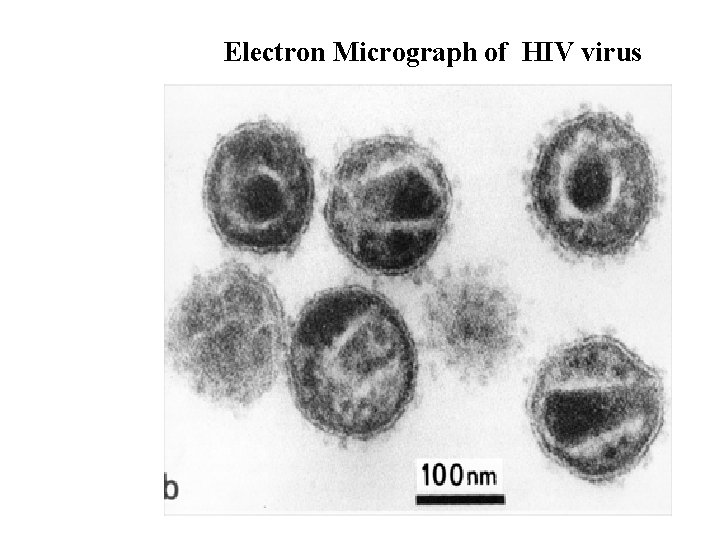 Electron Micrograph of HIV virus 