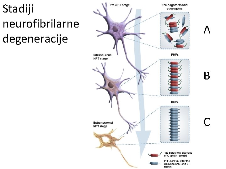Stadiji neurofibrilarne degeneracije A B C 