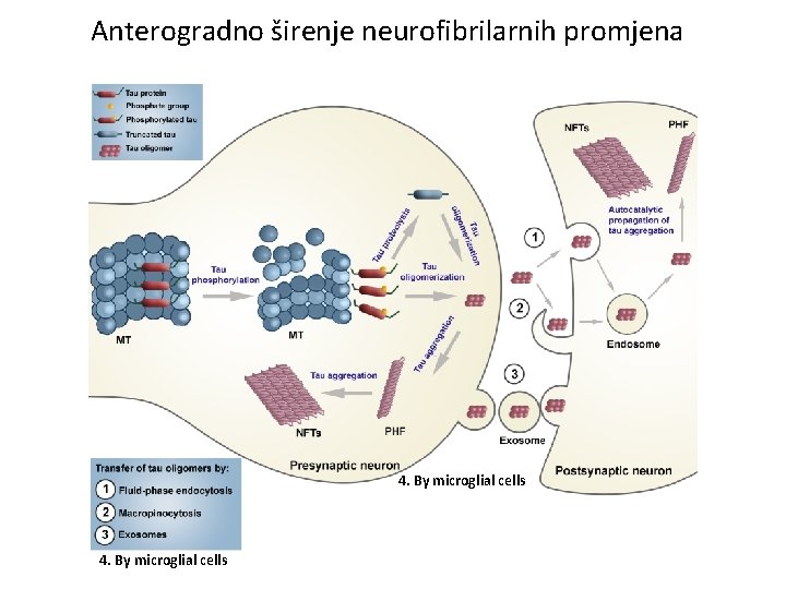 Anterogradno širenje neurofibrilarnih promjena 4. By microglial cells 