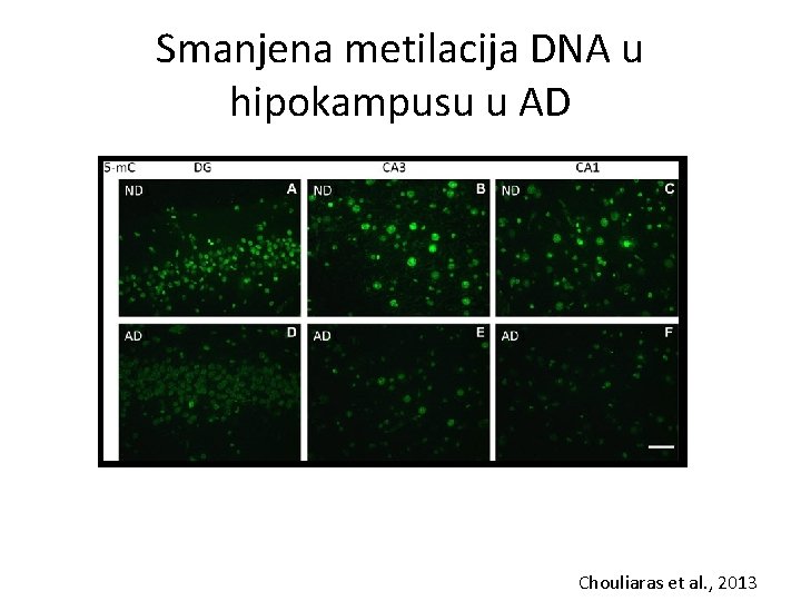 Smanjena metilacija DNA u hipokampusu u AD Chouliaras et al. , 2013 