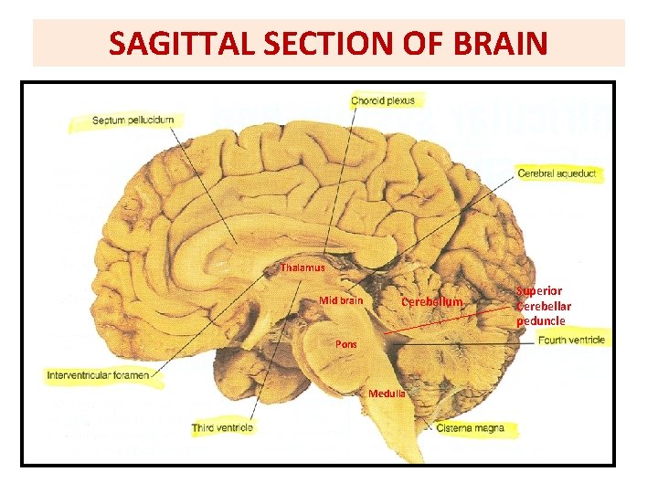 SAGITTAL SECTION OF BRAIN Thalamus Mid brain Cerebellum Pons Medulla Superior Cerebellar peduncle 