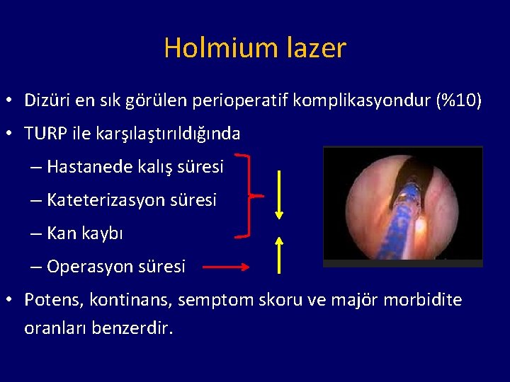 Holmium lazer • Dizüri en sık görülen perioperatif komplikasyondur (%10) • TURP ile karşılaştırıldığında