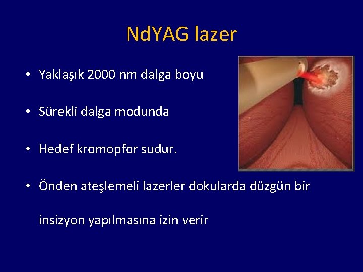 Nd. YAG lazer • Yaklaşık 2000 nm dalga boyu • Sürekli dalga modunda •
