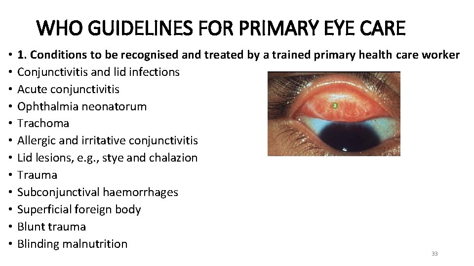 WHO GUIDELINES FOR PRIMARY EYE CARE • • • 1. Conditions to be recognised