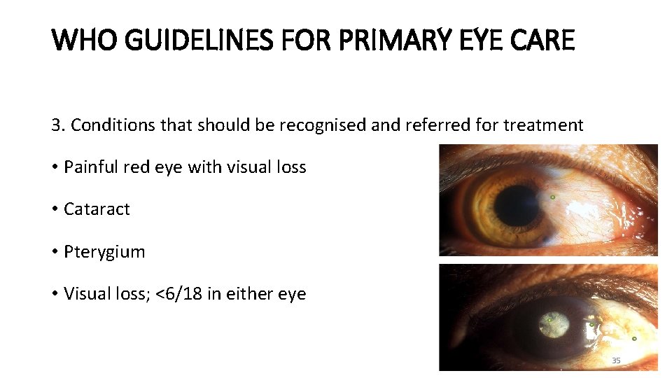 WHO GUIDELINES FOR PRIMARY EYE CARE 3. Conditions that should be recognised and referred
