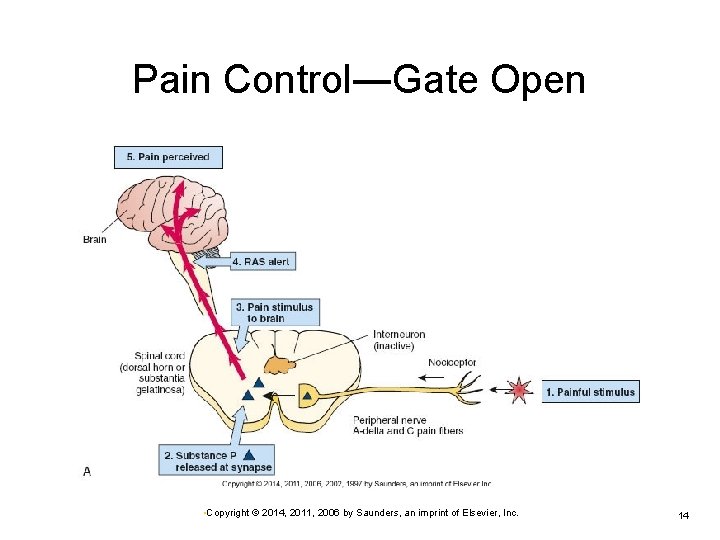 Pain Control―Gate Open • Copyright © 2014, 2011, 2006 by Saunders, an imprint of