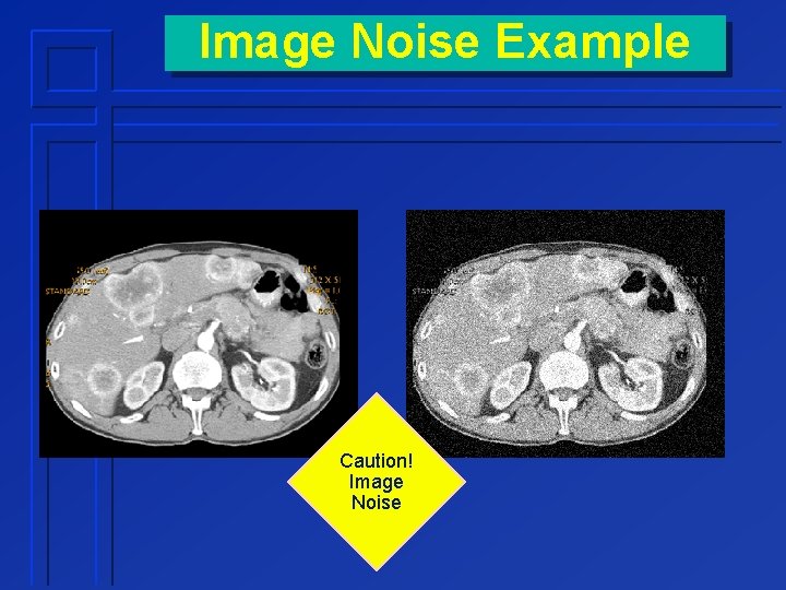 Image Noise Example Caution! Image Noise 