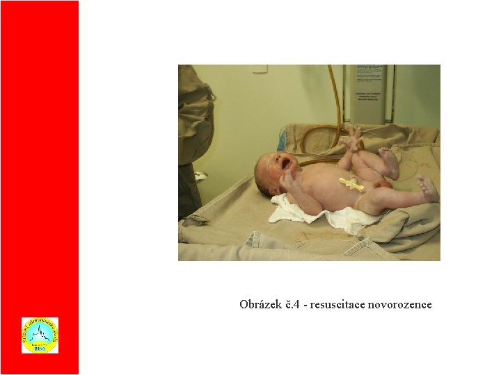 Obrázek č. 4 - resuscitace novorozence 