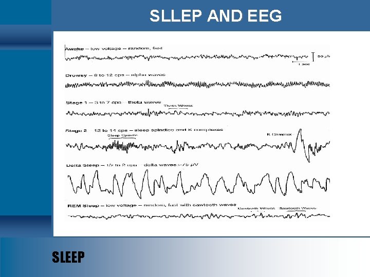 SLLEP AND EEG SLEEP 