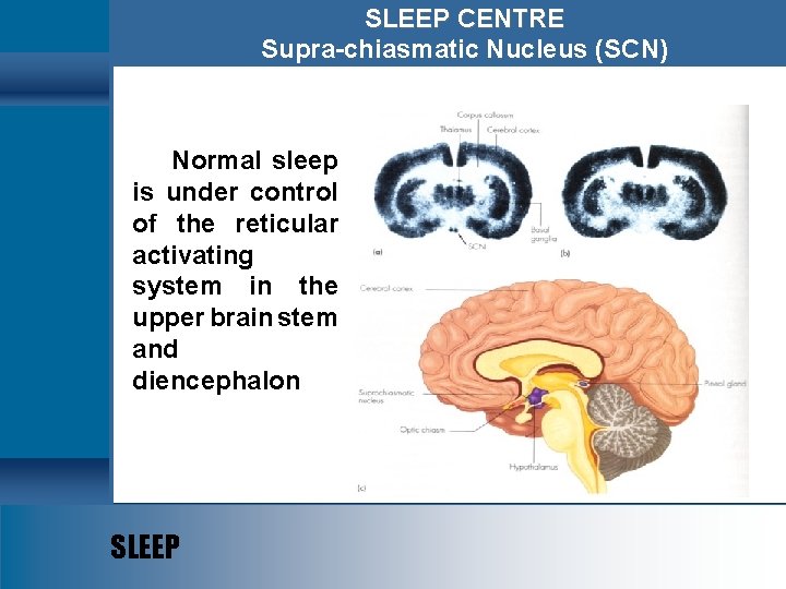 SLEEP CENTRE Supra-chiasmatic Nucleus (SCN) Normal sleep is under control of the reticular activating