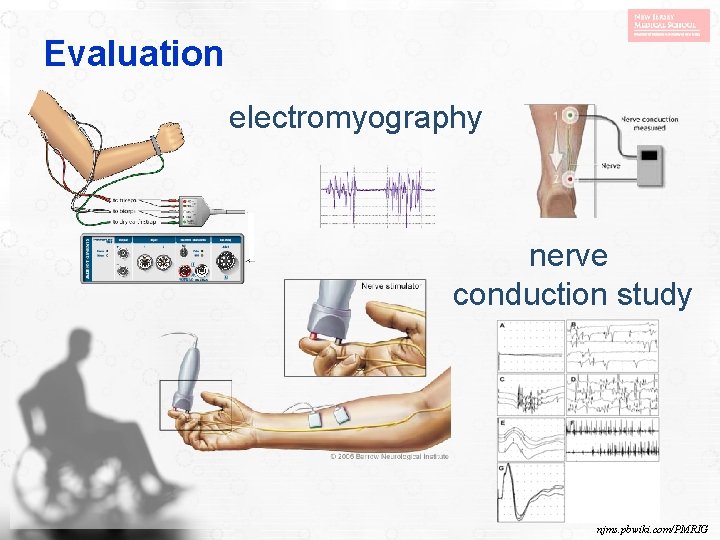 Evaluation electromyography nerve conduction study njms. pbwiki. com/PMRIG 