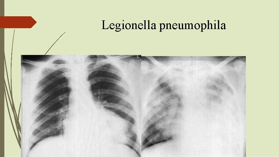 Legionella pneumophila 