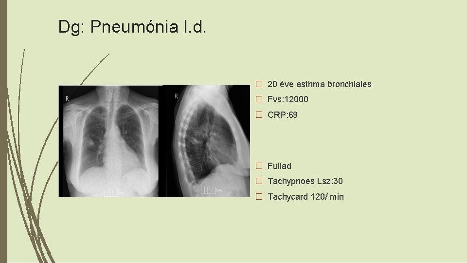 Dg: Pneumónia l. d. � 20 éve asthma bronchiales � Fvs: 12000 � CRP: